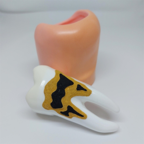 Stor Parodontitis Studiemodel 